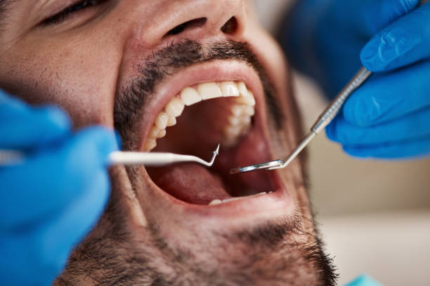 Best Emergency Dental Services for Seniors in Kingston, WA